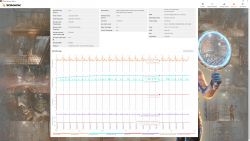 timespy-stresstest-ext-2.png